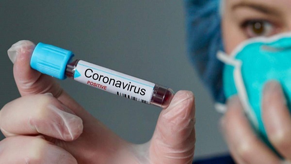 Coronavírus em Cuba
